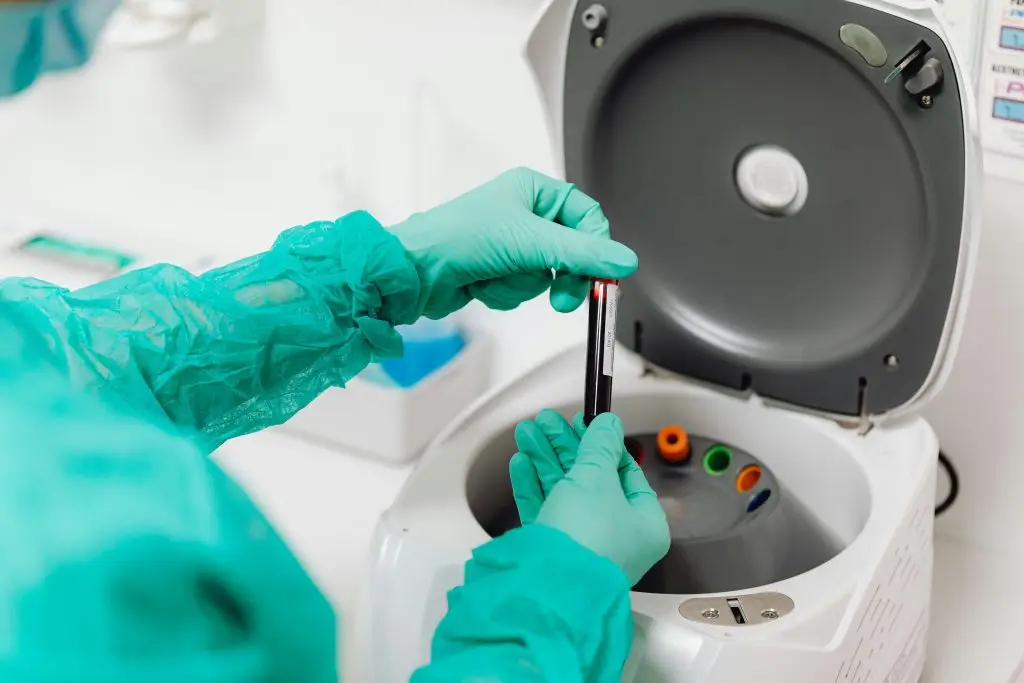 A person dressed in green scrubs engages with a machine, demonstrating the method for testing Vitamin D status through blood analysis.